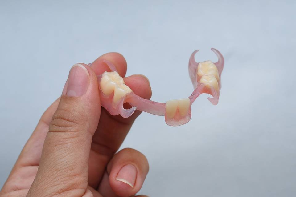 Flexible Partial Denture