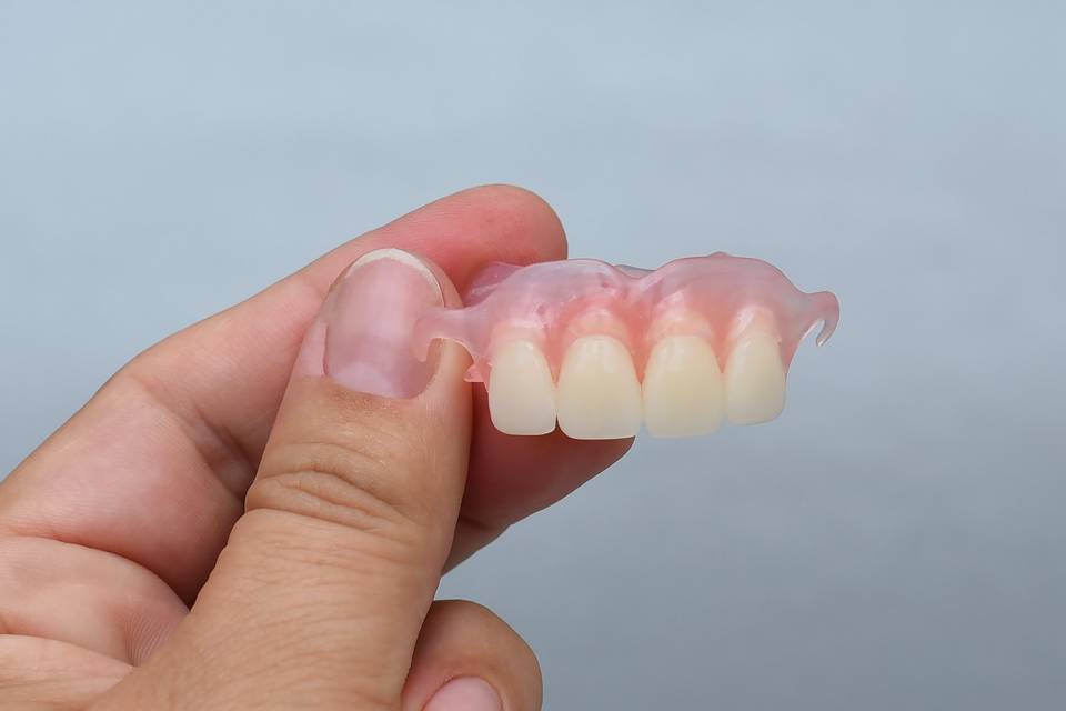 Flexible Partial Denture