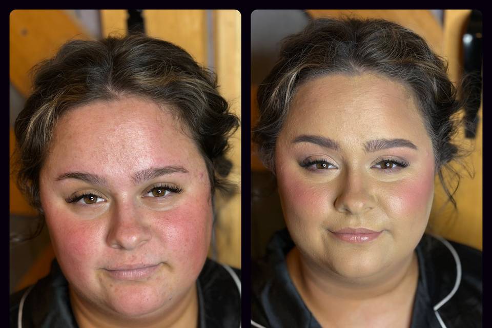 Before and after rosacea!