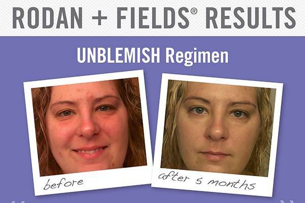 Rodan & Fields