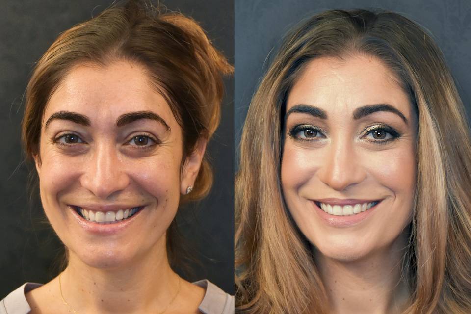 Before and after bridal trial
