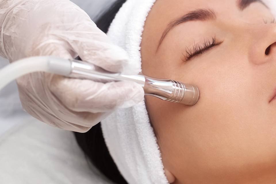 Microdermabrasion