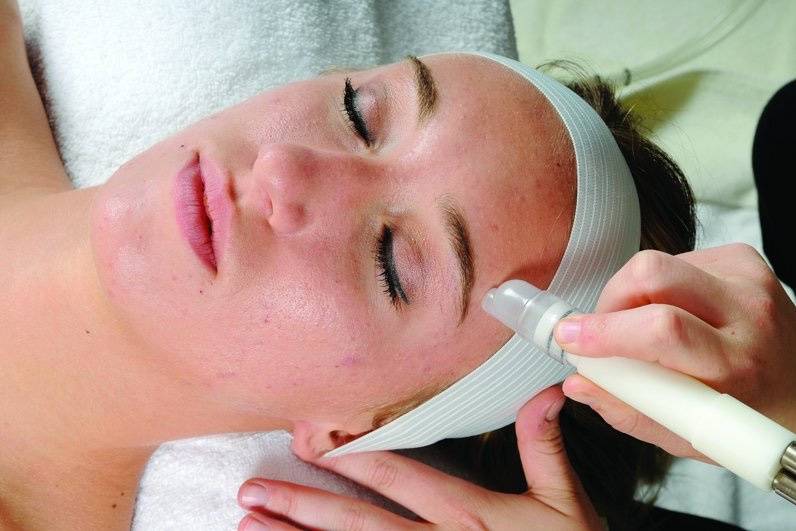 Microdermabrasion