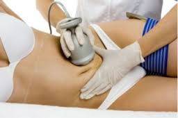 Ultrasonic cavitation