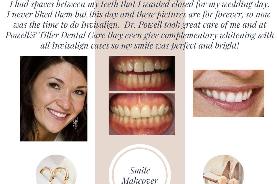 Powell & Tiller Dental Care