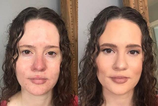 Before & After
